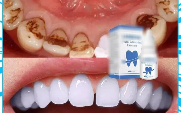Soins bucco-dentaires