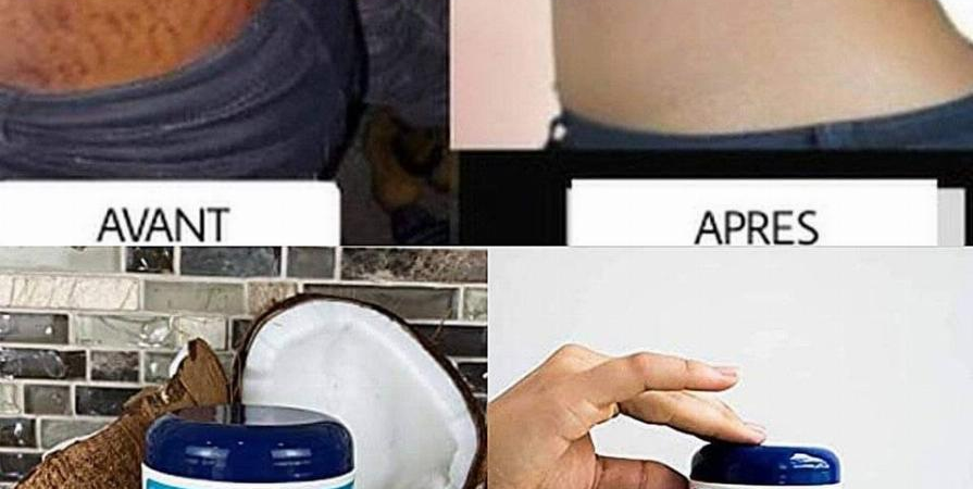 Soin de la peau